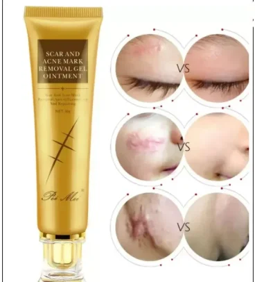 Pei Mei Scars Removal Cream, Non-Greasy Stretchmarks Lighten Cream, for All Skin Types (30g) - image 1